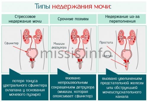 Vatten rinner i toaletten, hur man fixar Reparationsinstruktioner Video